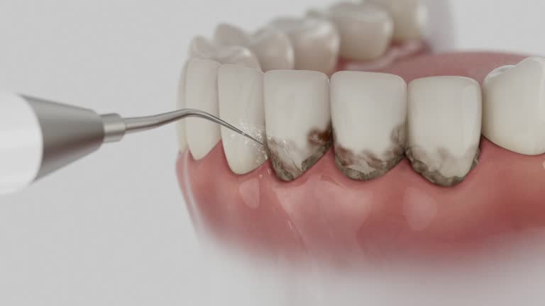 Reliable Dental Implants contractor in Algoma, WI by Smile Center Dentistry